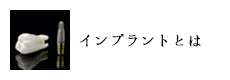 インプラントとは