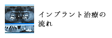 インプラント治療の流れ