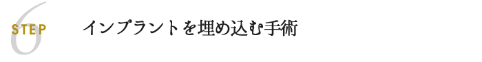 インプラントを埋め込む手術