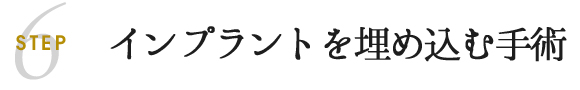 インプラントを埋め込む手術